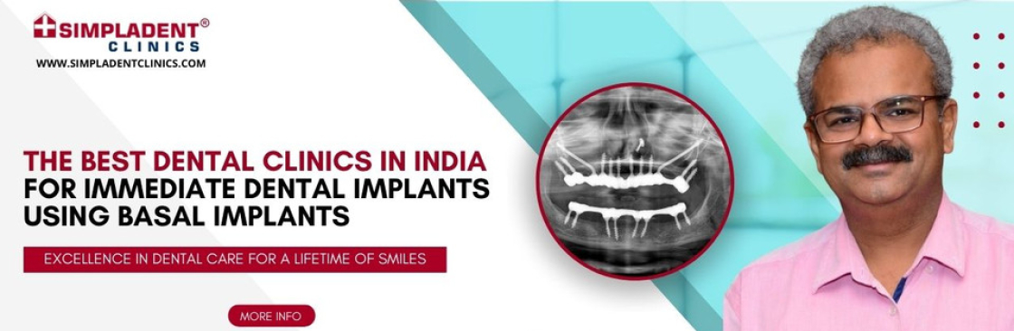 Immediate Loading Implants Immediate Loading Implantologist Cover Image