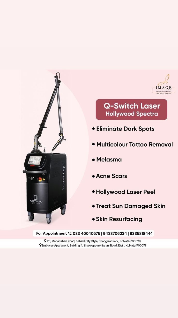 Pigmentation Removal with Q-Switch Laser