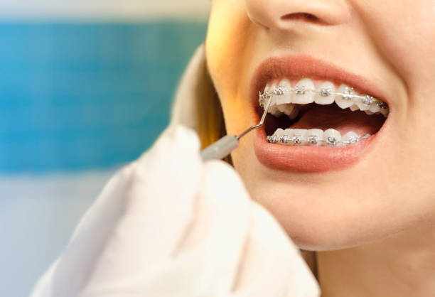 Transform Your Smile with Expert Care: Choosing the Right Orthodontic Solution