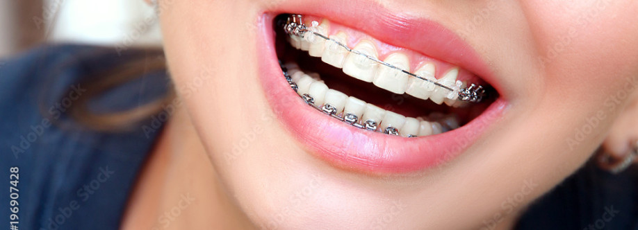 Transparent teeth Braces Cover Image